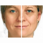 Gebelikte Açlık Kan Şekeri Kaç Olmalı?